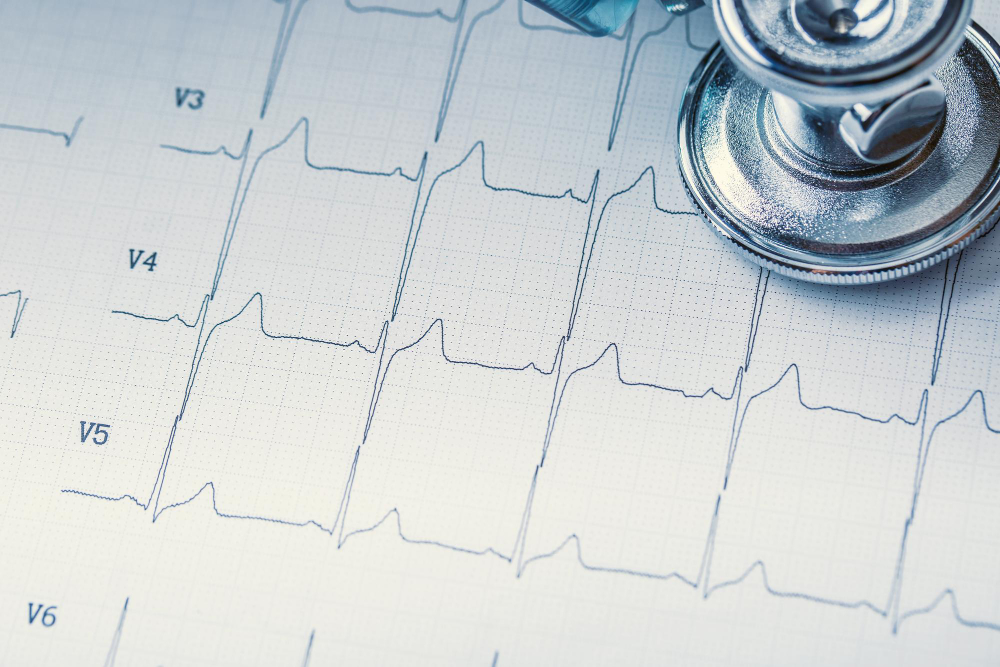 ECG_1, Srinivasa Hospital, Dr. K. Srinivas Rao